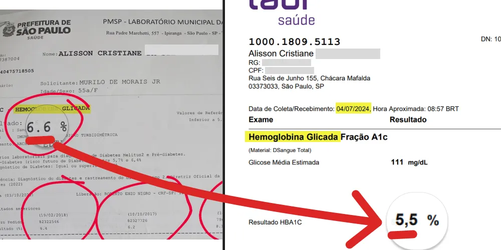 imagem de resultado de glicosímetro